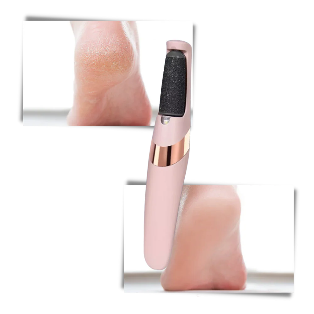 Electric skin remover for hard skin