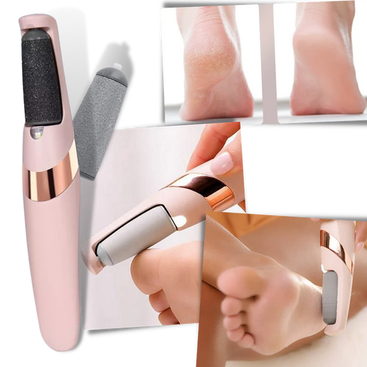 Electric skin remover for hard skin
