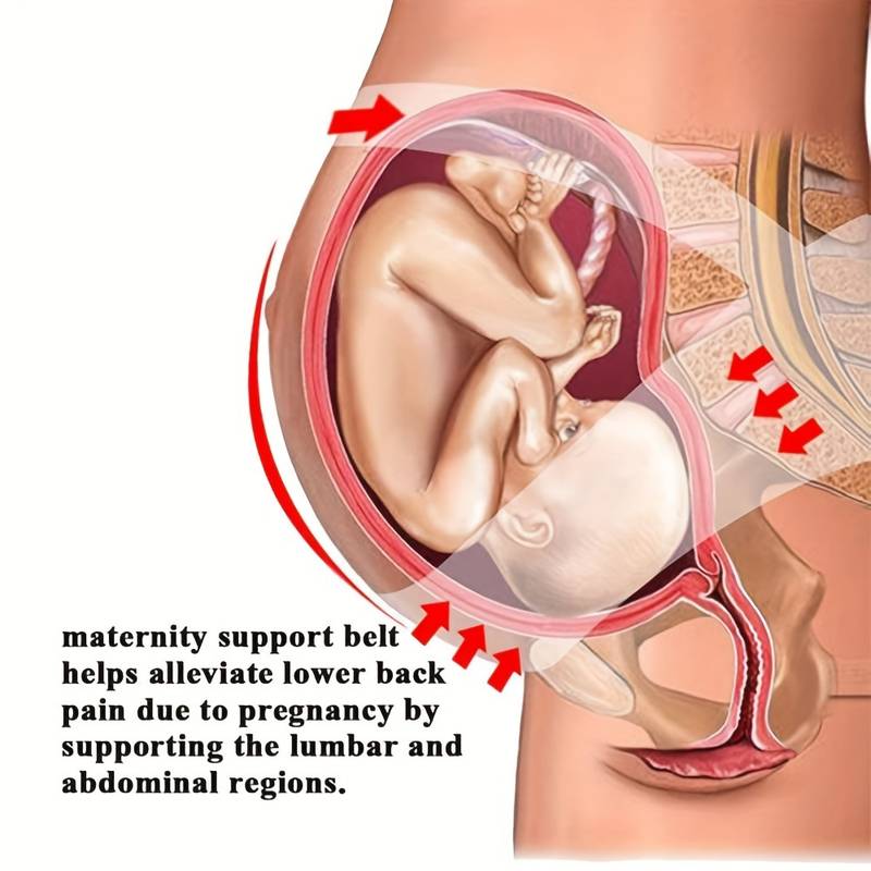 3 in 1 Pregnancy Back Support Belt Support Child Weight and Relieve Back Preasure 3830-10